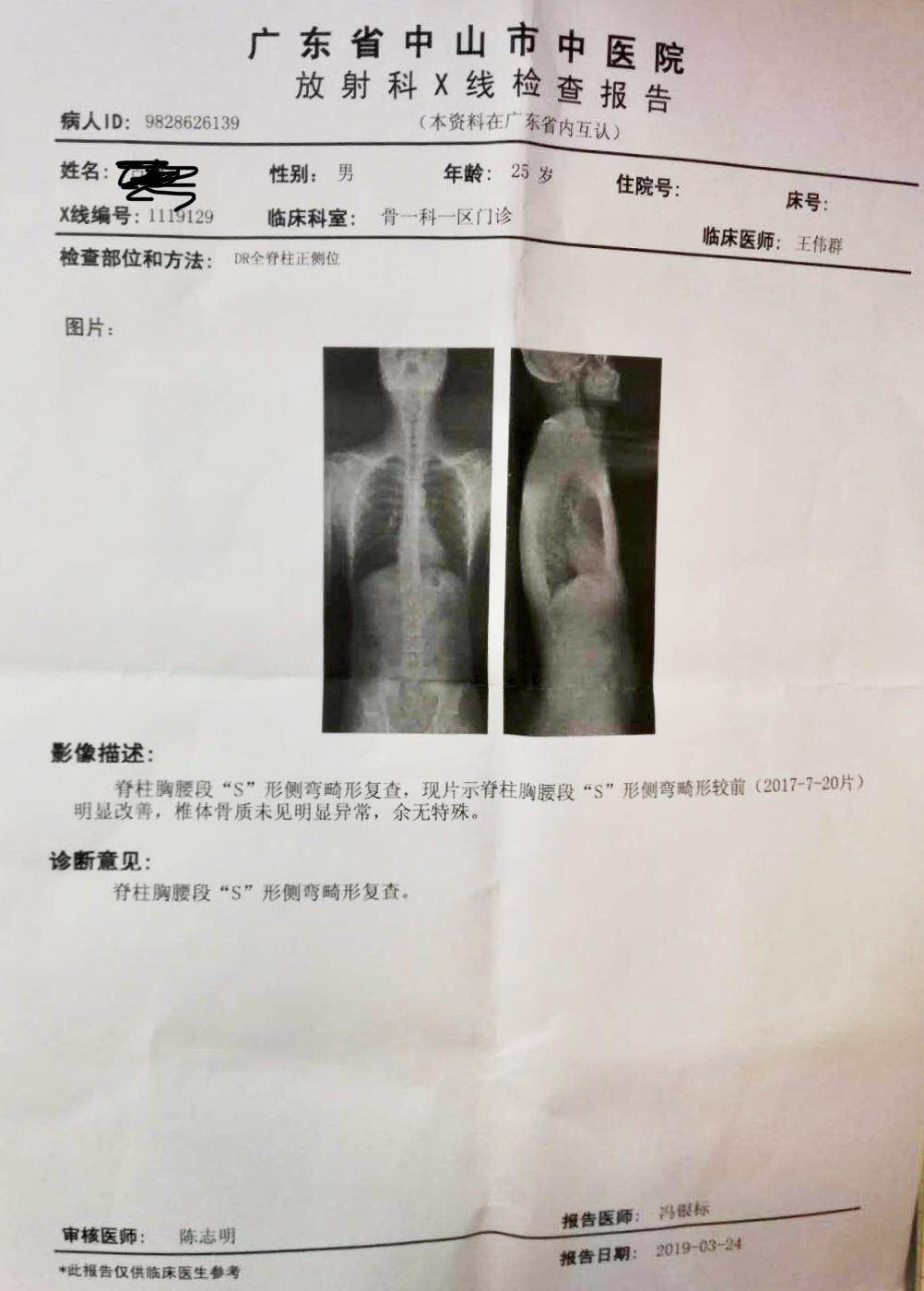 外星艙治療后檢查 外星艙治療后檢查