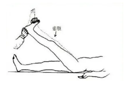 直腿抬高試驗(yàn) 直腿抬高試驗(yàn)