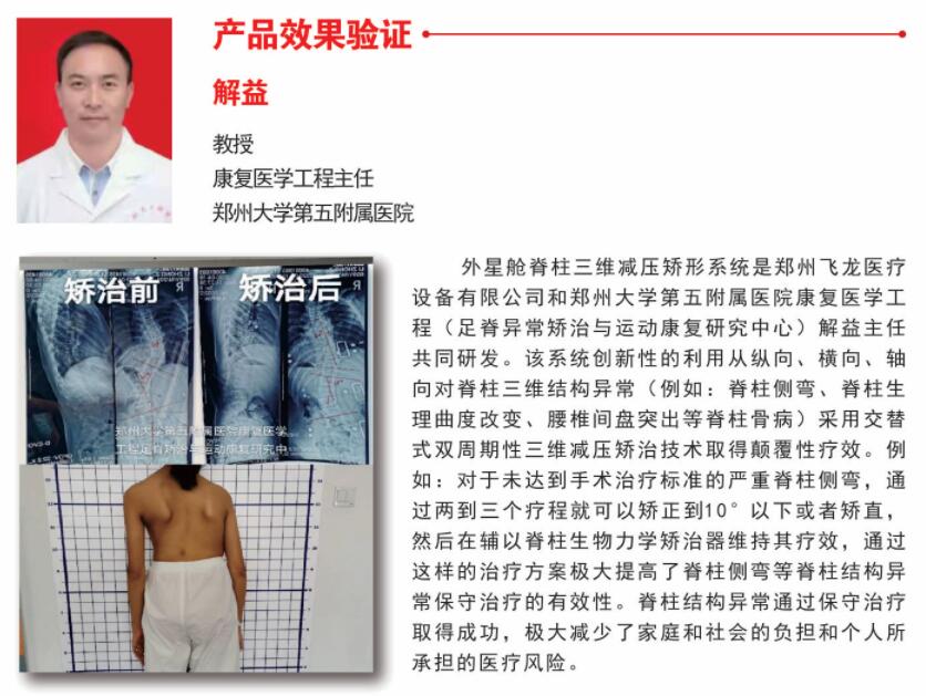 脊柱減壓治療區(qū)效果 脊柱減壓治療區(qū)效果